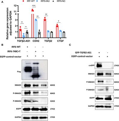 A novel IRF6 gene mutation impacting the regulation of TGFβ2-AS1 in the TGFβ pathway: A mechanism in the development of Van der Woude syndrome